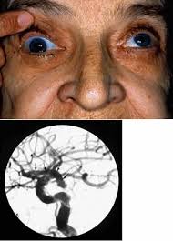 Foundation Volume 2, Chapter 9. The Iris and the Pupil