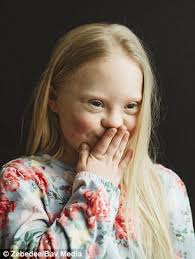 M&S hires child models with disabilities for school uniform campaign