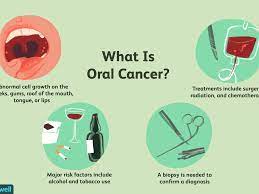 Other symptoms of tongue cancer. Oral Cancer Overview And More