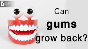 It happens when your gums pull back from your teeth, leaving the root beneath exposed and the first thing you. Gingival Recession Causes Treatment Can Gums Grow Back Dr Mr Pujari Youtube