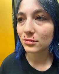 Fresh upper vertical lip piercings with high polish titanium curve  barbells. For appointments: (716)-545-3023.