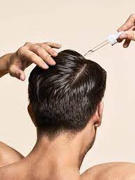 Minoxidil was first introduced as an oral medication for the treatment of severe and recalcitrant hypertension in the 1970s.1 coincidentally, physicians observed hair regrowth and generalized hypertrichosis in balding patients, which led to the development of a topical minoxidil formulation for treating androgenetic alopecia (aga) first in male and then in female individuals. How Long Before Minoxidil Starts Working Hims