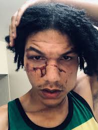 Five people intend to sue over injuries they suffered in melee with police 