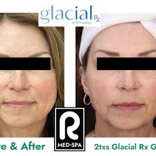 TOP 10 BEST Body Contouring near Durango, CO