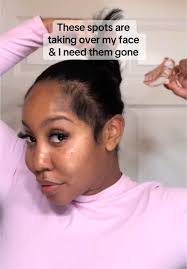 Inherited these instead of some land 😪 .My dermatologist is toop tier...