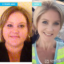 My gastric sleeve weight loss journey