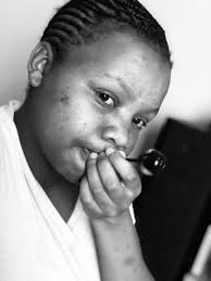 What can I use to remove dark spots?