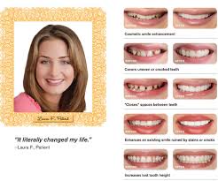 They will actually look extremely natural! Snap On Smile Brooklyn Cosmetic Dentists Orthodontists Periodontists Root Canals All Smiles Dental