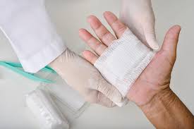 Image result for Wound