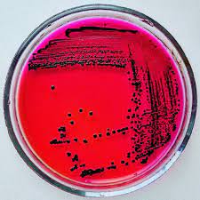 Xylose lysine deoxycholate agar is proposed as the sec … Salmonella Enteritidis Xld Agar Bacteria Shapes Microbiology Salmonella
