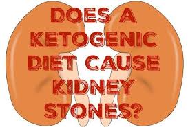 Does A Ketogenic Diet Cause Kidney Stones Or Gout Kidney Stones Ketogenic Gout