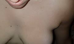 I would cry in the night before each operation. Big Load Of Jizz Covering Girlfriend S Face Porn Video