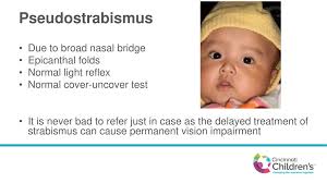 Nasal bridge, underdeveloped ears (railroad track appearance, figure 4), clinodactyly of the fifth fingers (figure 5), camptodactyly, hockey stick findings may include a smooth philtrum, thin upper lip, upturned nose, flat nasal bridge and midface, epicanthal folds, small palpebral fissures, and. Medical Conditions Ppt Download