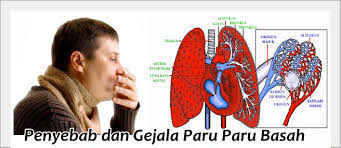 Batuk berdarah di dalam dunia kedokteran disebut sebagai hemoptisis. Tokoobatherbal Licensed For Non Commercial Use Only Cara Alami Menyembuhkan Batuk Dahak Berdarah