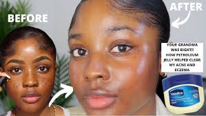 5 TIPS THAT IMPROVED MY SKIN DRAMATICALLY!!| KAISERCOBY