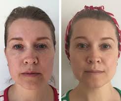 Und genau diese notsituation gaukelt man dem körper mit dem. Gesichtsyoga Ubungen Fur Ein Straffes Strahlendes Hautbild