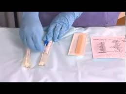 Sample Collection Throat Swabs Youtube