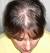 Hairstyles For Thinning Hair In Front
