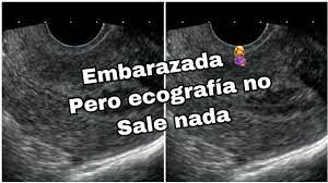 Prueba De Embarazo Positiva Pero No Se Ve Nada En La Ecografia Store Www Lactando Org
