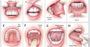 Though oral cancers have long been linked to smoking, head and neck surgeon brandon prendes, md, says current research shows that hpv is directly successful treatment and cure rates are high if you know what to look for and know your risk, he says. Hopkin Oral Surgery Oral Cancer Doesn T Just Target Smokers