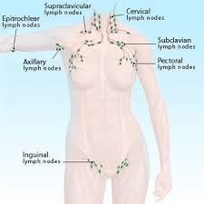 Instant Remedies For Swollen Lymph Nodes Causes And Symptoms Swollen Lymph Nodes Lymph Nodes Lymph Glands