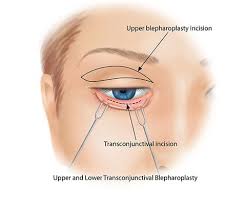 Image result for Blepharis transvaalensis