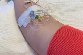 Fundraiser by Samuel Au : Help Elsa Beat Cancer