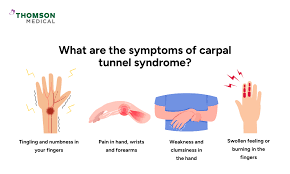 Image result for Carpal Compression Test