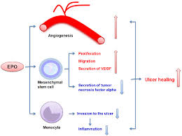 However, it is now recognized that infection occurs as a. Pdf Growth Factors In The Pathogenesis Of Diabetic Foot Ulcers Semantic Scholar