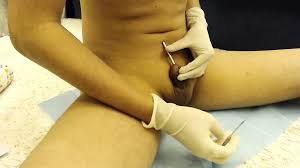 Getting Cock Pierced Prince Albert Pa: Gay BDSM Porn | xHamster