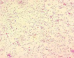Hygiene & diseases of warm climates. Brucellosis Wikipedia