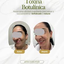 CLÍNICA DE BIOMEDICINA E ESTÉTICA AVANÇADA (@clinica.belli) · Poços de  Caldas, MG