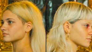 Identical twins Jim Lewis and Jim Springer were separated at birth but went 