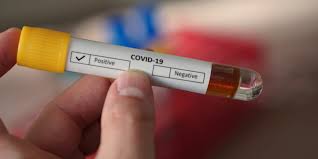 A positive result means it's likely you had coronavirus when the test was done. Coronavirus Can You Get A Home Test Kit For Covid 19 Which News