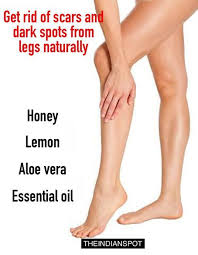 Leg Bio Oil Before And After Scars Pin On Bio Oil Dark Circles