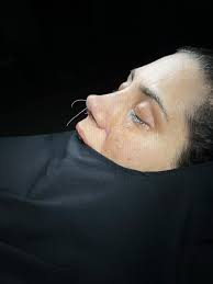 Hi everyone. I have been dreaming of plastic surgery