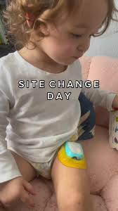 Out with the old!! #byeomnipod #sitechange #type1diabetes #omnipod #di...