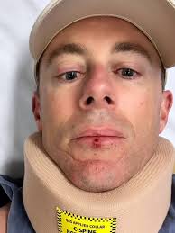 Casey Barnes 'shaken' after Gold Coast car crash