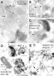 02.11.2019 · la bloc episodul 390. Bloc 1 Interacts With Bloc 2 And The Ap 3 Complex To Facilitate Protein Trafficking On Endosomes Molecular Biology Of The Cell