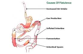 Image result for Flatulence