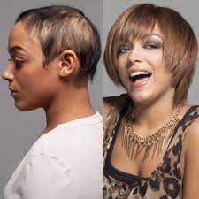 Example Of Virtuesse Hair By Virtual Reality Hair Restoration Hair Womens Hairstyles