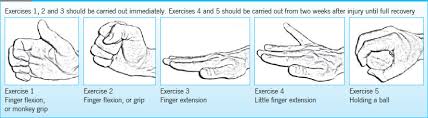 Occasionally it is used to refer to fractures of the 4th metacarpal as well. Boxer S Fracture Management And Outcomes