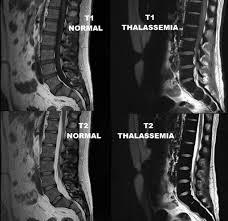 Pin On Radiologie Msk