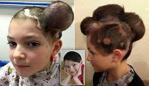 ٨ مخاطر عملية الماء الأبيض. Ù‡Ø°Ø§ Ù…Ø§ Ø­Ø¯Ø« Ù„Ù‡Ø§ Ø¨Ø³Ø¨Ø¨ ÙˆØ­Ù…Ø© ÙƒØ¨ÙŠØ±Ø© ÙƒØ§Ù†Øª ØªØºØ·ÙŠ Ø±Ø£Ø³Ù‡Ø§ Ù‚Ù†Ø§Ø© Ø§Ù„Ø¹Ø§Ù„Ù… Ø§Ù„Ø§Ø®Ø¨Ø§Ø±ÙŠØ©