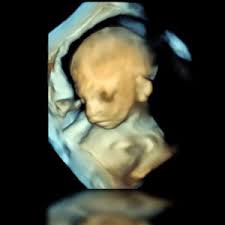 25 (24 + 5) schwangerschaftsmonat: 3d 4d Ultraschall Fotogalerie
