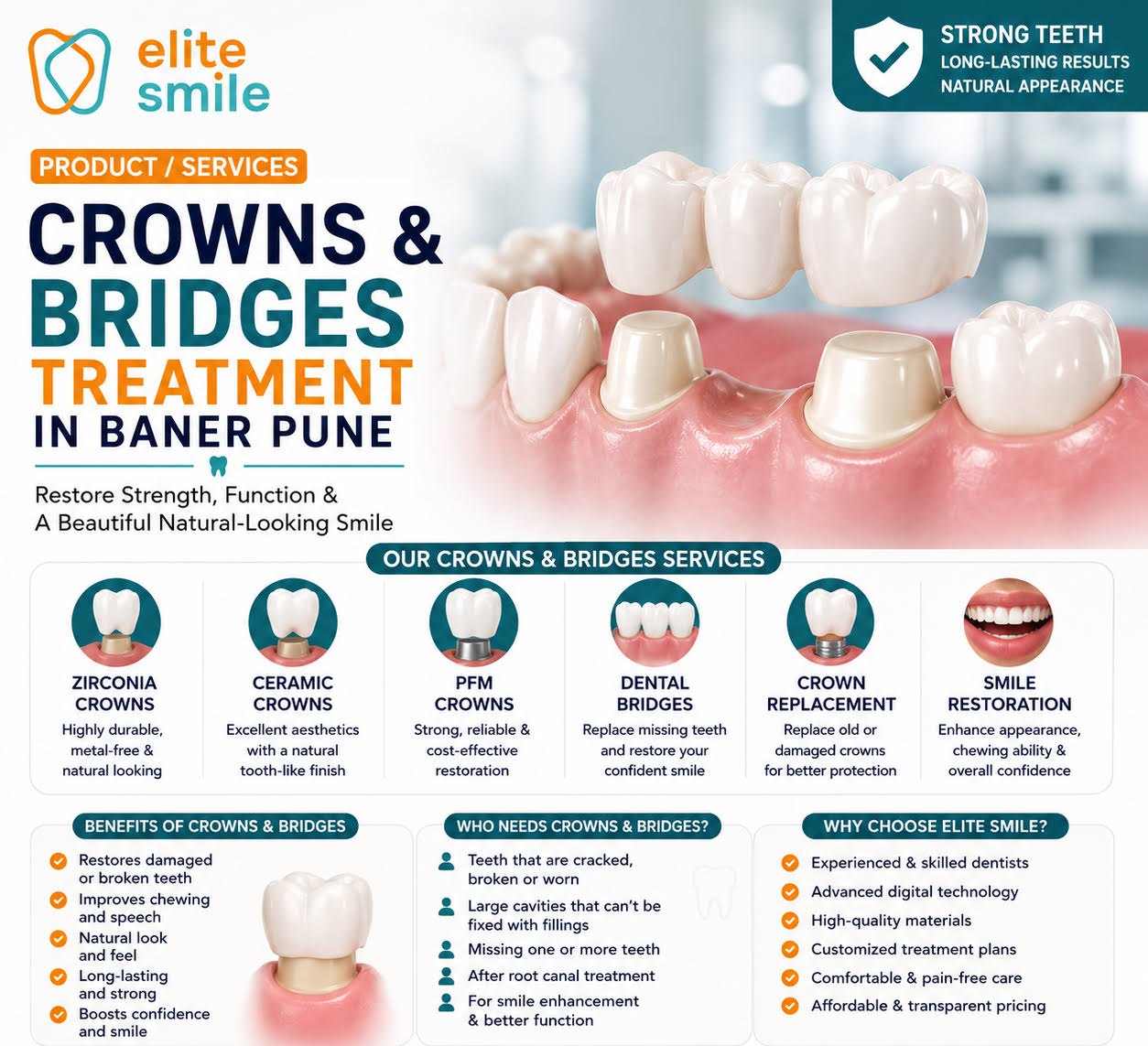 Crowns & Bridges Treatment in Baner Pune | Dental Crowns product image