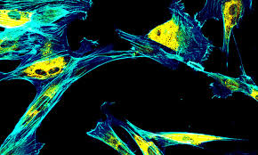 Image result for Polarized Microscopy