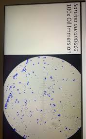 Join facebook to connect with sarcina lutea and others you may know. Solved Sarcina Aurantiaca 100x Oil Immersion Results A S Chegg Com