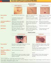 Hemangioma and other types of angiomas. Manual Of Medicine On Twitter Some Vascular And Purpuric Lesions Of The Skin Meded Foamed Usmle Medicine