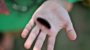 Black And Red Fuzzy Caterpillar Are Black Fuzzy Caterpillars Poisonous Black Fuzzy Caterpillar Fuzzy Caterpillar Poisonous Caterpillars